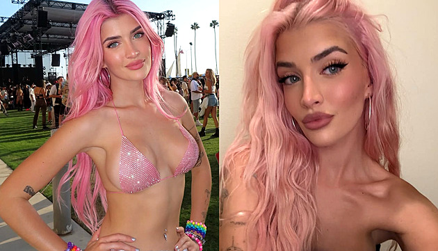 Dcera Charlieho Sheena ukázala, jak vypadala před plastikami. Jsem posedlá, říká