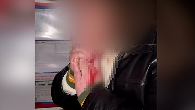 VIDEO: Muž v Jenštejně pořezal mladíka na krku, jen těsně minul tepnu